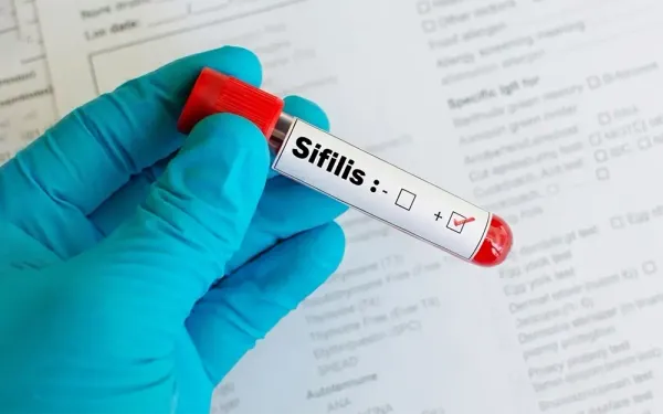 Escobar refuerza testeos para controlar el aumento de sífilis en jóvenes